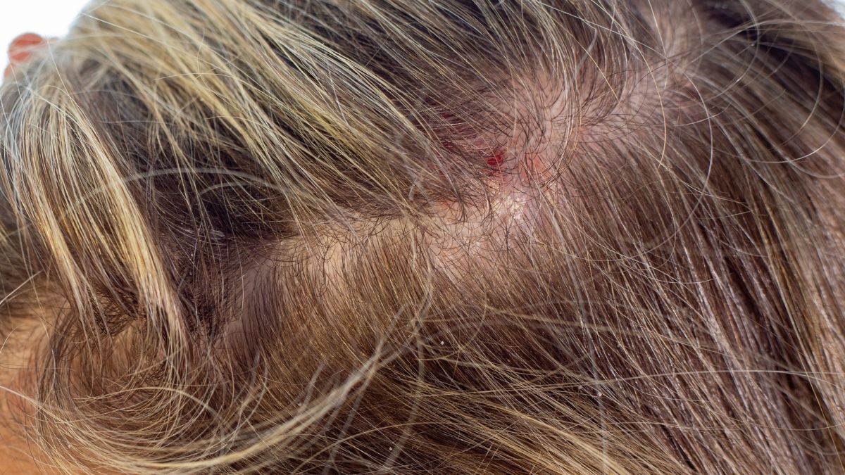 The Scalp Is the Skin You're Ignoring (And It Shows in Your Hair)