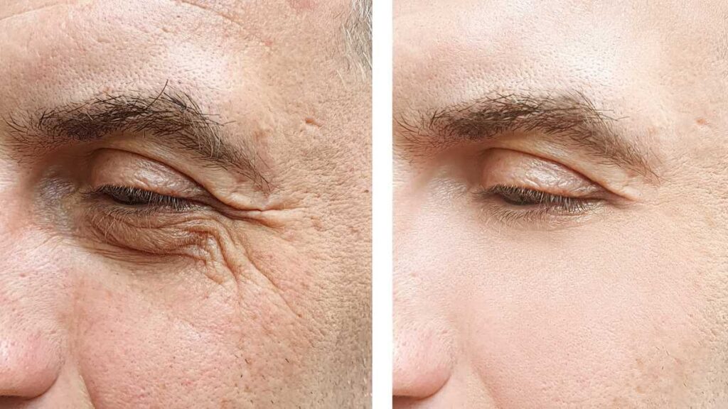 What Changes in Your Skin After 30 Days of Actually Doing This